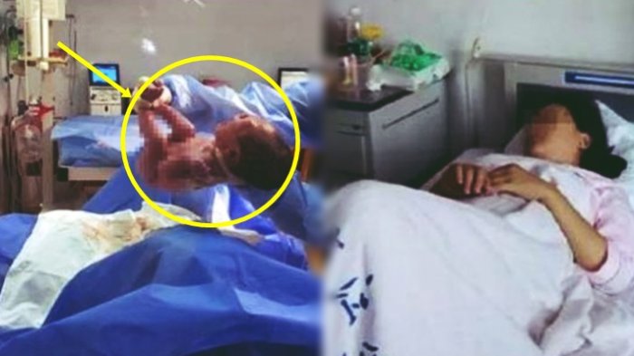 Wanita Ini Hamil 4 Kali Dalam Kurun 5 Tahun,Saat Dioperasi,Dokter Kaget Melihat Kondisi Rahimnya