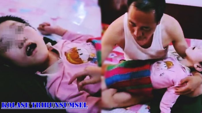 Mengharukan ! Perjuangan Pasangan Ini Rawat Anak yang Cacat Selama 16 Tahun,Kisahnya Bikin Nangis