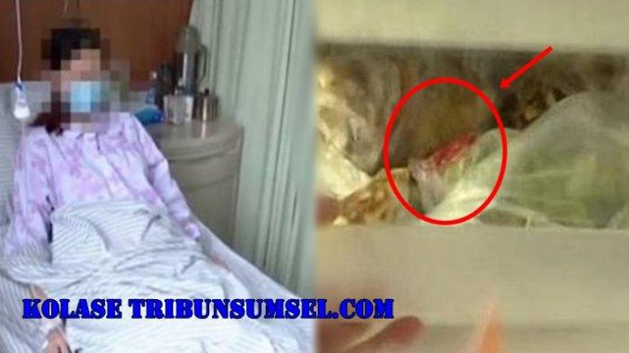 Wanita Ini Keguguran Saat Hamil 7 Bulan Karena Infeksi Bakteri Berbahaya,Penyebabnya Makanan Ini