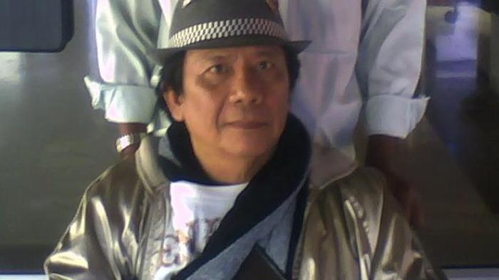 Benny Panjaitan 'Panbers' Terbaring Koma di ICU