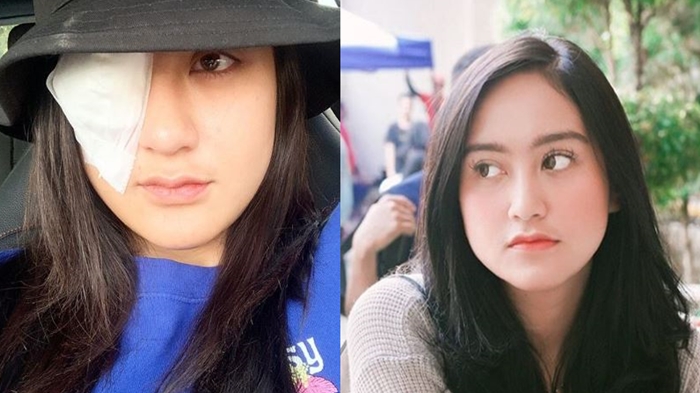 5-tahun-gunakan-softlens-pesinetron-salshabilla-adriani-nyaris-alami-kebutaan.jpg