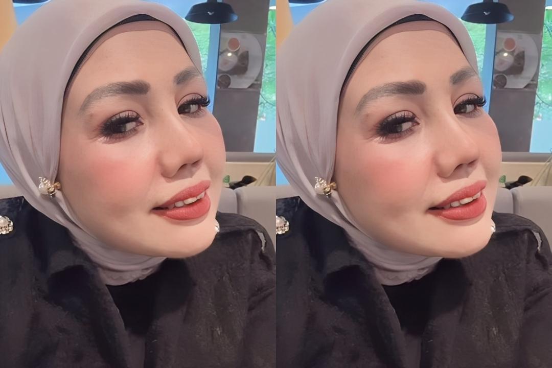 Segini Kisaran Biaya Operasi Plastik Elly Sugigi untuk Permak Hidung dan Mata di Usia 55 Tahun - Tribunsumsel.com