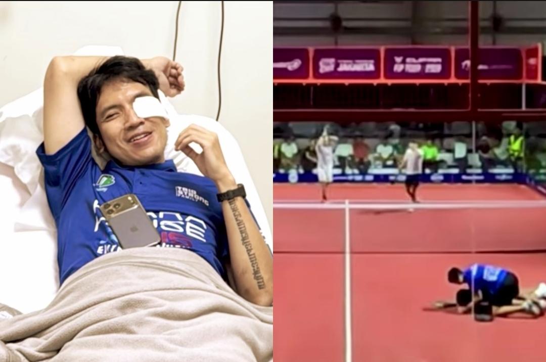 Detik-detik Mata Desta Kena Pukulan Bola Padel hingga Penglihatan Gelap, Sempat Takut Buta Permanen - Tribunsumsel.com