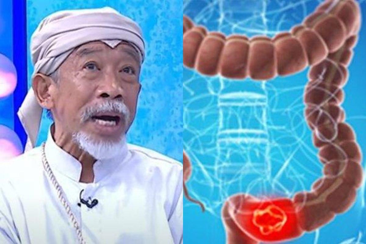 Mengenal-Kanker-Usus-Penyakit-Sebabkan-Pelawak-Nurul-Qomar-Meninggal-Dunia.jpg