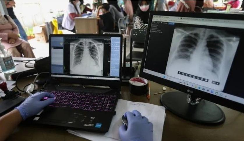 Kasus TB Masih Tinggi, Kemenkes Andalkan Portable X-Ray untuk Percepat Skrining - Tribunsumsel.com