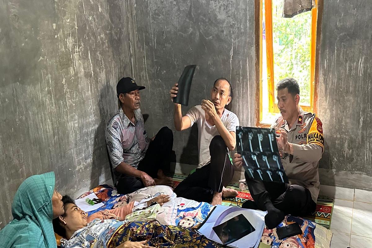 Rok Nyangkut di Jari-jari Motor, Wardatun Guru PPPK SD di Muba Kecelakaan, Tulang Engsel Bergeser