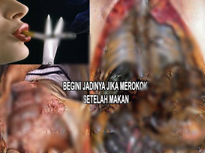 bahaya-merokok-sesudah-makan_20151128_133849.jpg