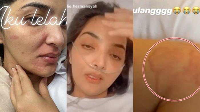 foto-ashanty-dulu-saat-jatuh-sakit-beberapa-waktu-lalu-kini-berjuang-lawan-covid-19.jpg