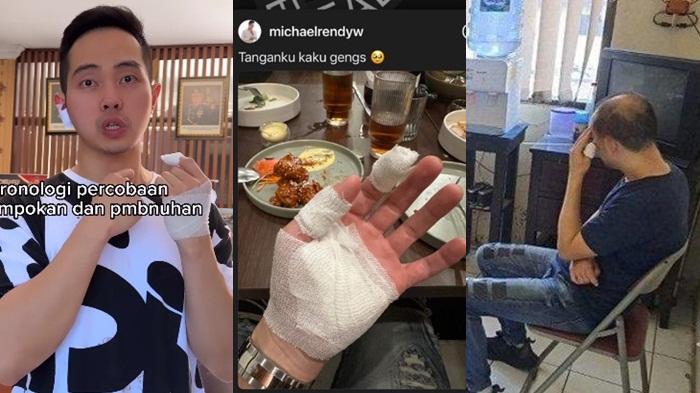 kondisi-selebgram-michael-rendy-menjadi-korban-perampokan.jpg