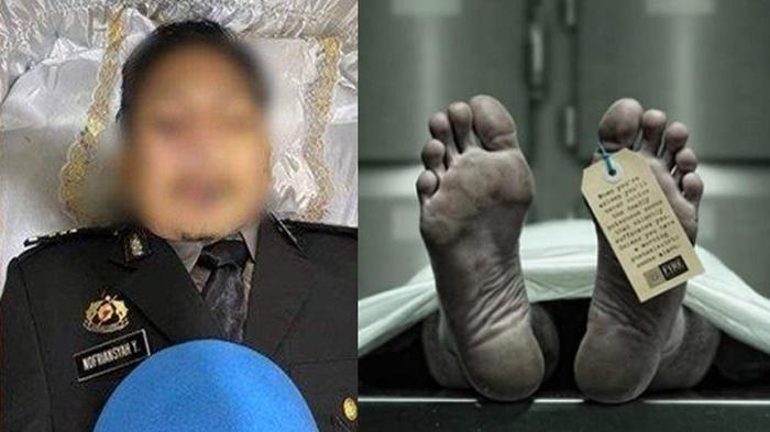 Leher Brigadir J Dijerat Lalu Ditembak, Analisa Tim Kuasa Hukum Brigadir J : Goresan dan Memar Leher