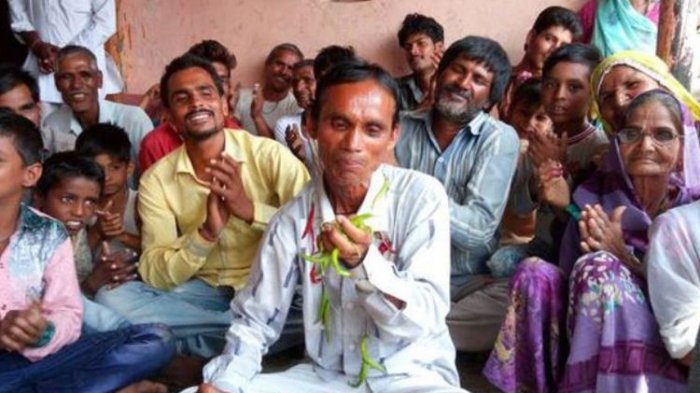 6 Tahun Makan Cabai 3 Kg Tiap Hari, Begini Kondisi Pria India Ini Sekarang