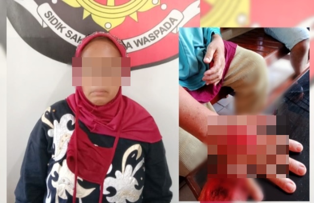 Nenek 63 Tahun di Prabumulih Gigit Tangan Tetangga Gegara Dilarang Ambil Air, Kini Berbuntut Panjang