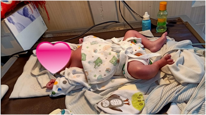 Dinamai Rara, Bayi Ditemukan di SPBU Sungai Lilin Masih Dirawat Intensif, Polisi Buru Pembuang Bayi