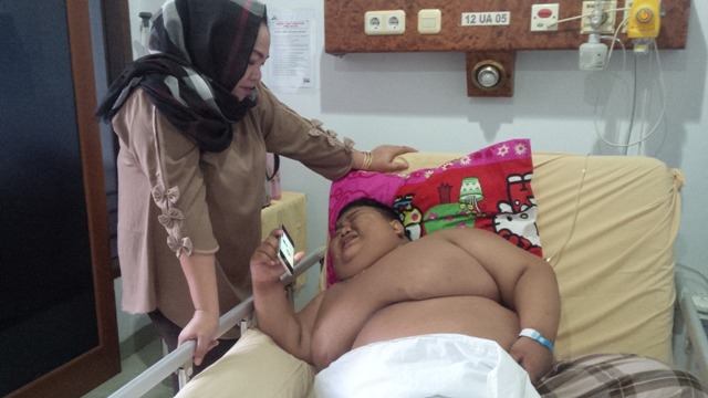 Heboh Bocah Gemuk, Baru 11 Tahun, Berat Rizki Sudah 119 Kilogram