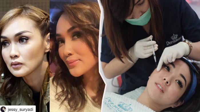 Terkuak! Rahasia 7 Selebriti Punya Pipi Tirus, Istri Gading Marten Rela Wajahnya Diginiin