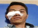 Andi-Salahuddin-wartawan-dibegal-di-Lubuklinggau-korban-luka-bacok-di-wajah.jpg