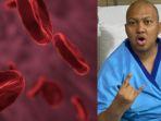 Apa-Anemia-AplastikPenyakit-Langka-Auto-Imun-Serang-Sumsum-Tulang-Sebabkan-Babe-Cabita-Meninggal.jpg