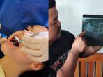 Fakta-Cabut-Gigi-Bungsu-Apakah-Berbahaya-Viral-Kasus-Wanita-di-Ngawi-Meninggal-Operasi-Gigi-Bungsu.jpg