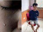 Kondisi-Pilu-Bocah-3-Tahun-Dianiaya-Pacar-Tante-Hingga-Tak-Sadar-Kini-Koma-Pakai-Alat-Bantu-Medis.jpg