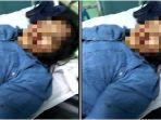 Update-wanita-korban-jambret-di-Lapangan-Hatta-Palembang.jpg