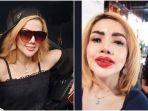 bak-korban-malpraktik-barbie-kumalasari-sempat-menyesal-lakukan-sulam-bibir-untuk-endorse.jpg