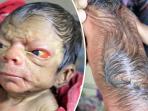 eorang-bayi-di-bangladesh-yang-lahir-dengan-kondisi-seperti-orang-berusia-80-tahun_20160929_144630.jpg