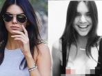 kendall-jenner-payudara_20151105_192147.jpg