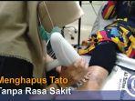 menghapus-tato-dengan-laser-di-palembang.jpg