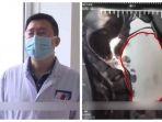 setelah-dieriksa-dokter-orang-tua-kaget-mengetahui-kenyataan-ini.jpg