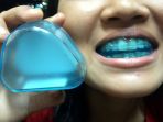 teeth-trainer_20181108_140837.jpg