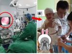 usus-bayi-kena_20170825_051455.jpg