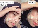 video-tiktok-milik-fahira-alfhi-diningrat-infeksi-masker-kain.jpg