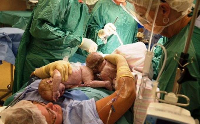 Wanita Ini Keluarkan Sendiri Dua Bayi dari Dalam Perut - 24E76D3400000578-2919507-image-a-2_1421842844540.jpg