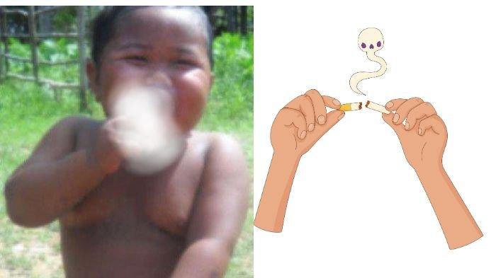 Ingat Ardi Rizal, Balita Perokok Dulu Viral Habiskan 40 Batang Sehari ...