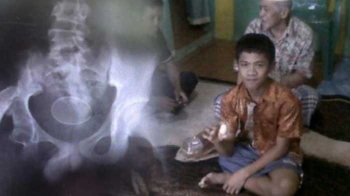 Primat porno onlayn tomosha qiling Eshak ustida jinsiy aloqa