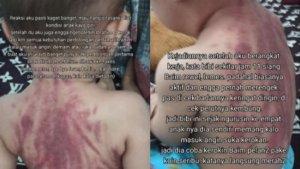 Seorang-bayi-berusia-13-tahun-dikeroki-hingga-viral-begini-penjelasan-dari-dokter.jpg