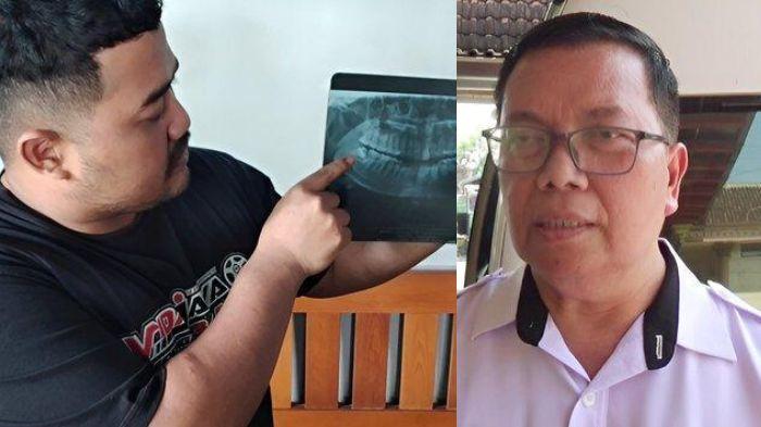 5-Fakta-Kasus-Wanita-Wafat-usai-Cabut-Gigi-Bungsu-Kondisi-Sempat-Membaik-Ini-Tanggapan-Dinkes.jpg