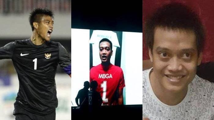 Apa-Kabar-Kurnia-Meiga-yang-Idap-Penyakit-Mata-Ini-Kondisinya-Impiannya-Diwujudkan-Erick-Thohir.jpg