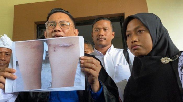Hasil-Visum-Anak-Aipda-WH-Janggal-Pangacar-Guru-Supriyani-Soroti-Dokter-Pembuat-Surat-Tak-Kompeten.jpg