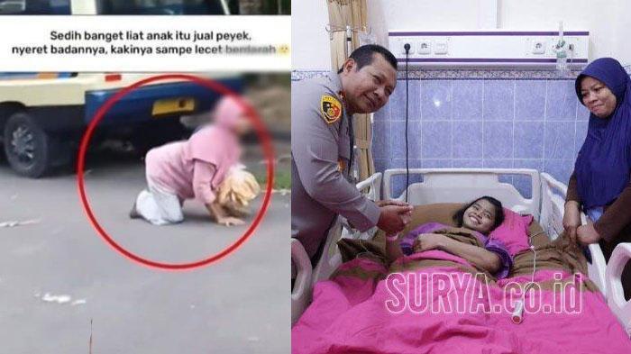 Ingat-Anak-yang-Viral-Jualan-Peyek-Sambil-Merangkak-di-Surabaya-Kini-Ada-Peluang-Bisa-Jalan-Normal.jpg