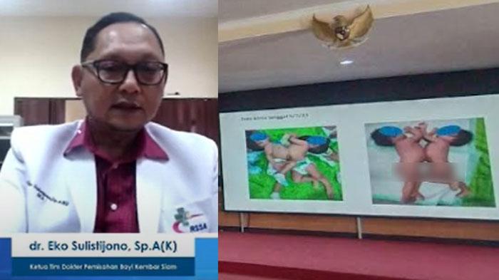 Ketua-Tim-dokter-Pemisahan-bayi-kembar-siam-dr-Eko-Sulistijono-SpAK-kiri.jpg
