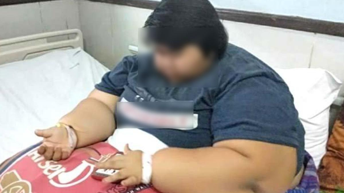 Hormon Remaja Picu Obesitas saat Kurang Tidur, Ini Penjelasan Dosen FK Unair Surabaya