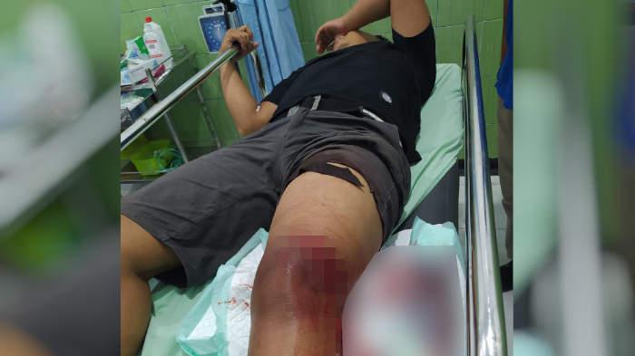 Pengeroyokan di Driyorejo Gresik, Satu Korban Alami Luka Bacok dan Dilarikan ke Rumah Sakit