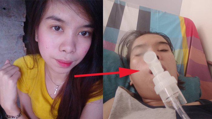 Wanita Asal Filipina Ini Sering Main Mobile Legend 8 Jam Sehari Nonstop, dan Lihat Akibatnya!