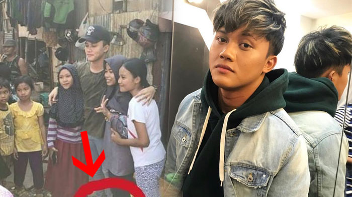 Dikenal Ganteng dan Bersuara Merdu, Kaki Rizky Febian di Foto Ini Lha Kok. . .