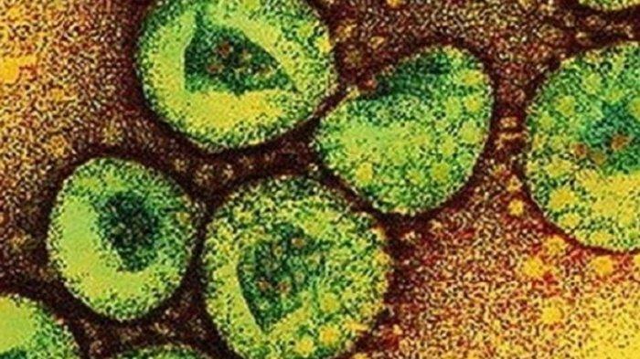 5 Poin Foto jenazah PDP COVID-19 di Surabaya Cuma Kenakan Popok yang Viral dan Penjelasan Lengkap RS