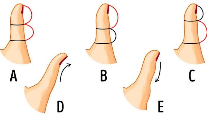 Tes Kepribadian - 5 Tipe Jempol Berikut Ungkap Karakter Aslimu, Fleksibel atau Keras Kepala?