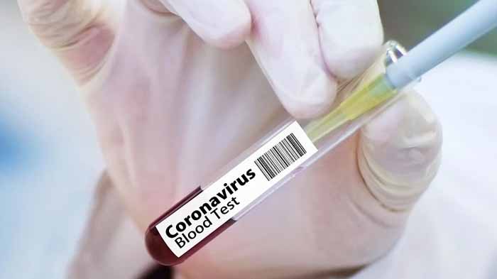 uji-coba-vaksin-oxford-pada-monyet-berhasil-cegah-covid-19-bulan-depan-diuji-ke-6000-orang.jpg