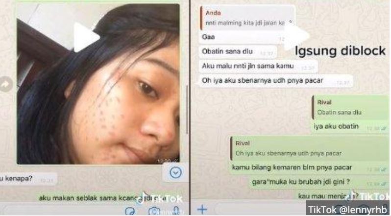 viral-di-tiktok-prank-gebetan-wajah-jerawatan.jpg