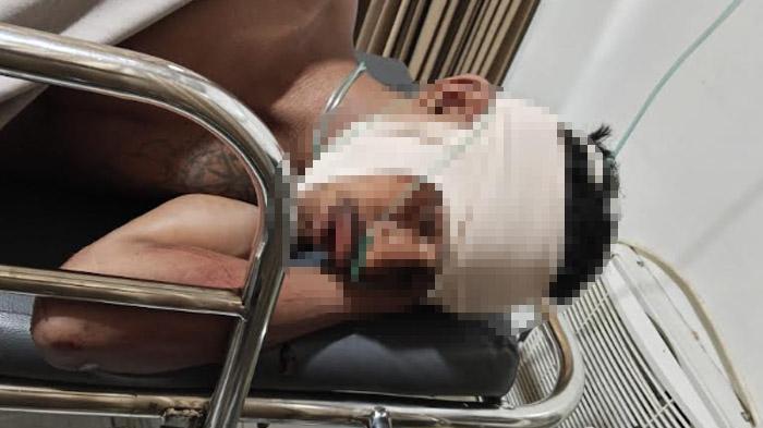 Aduh, Kenekatan Mencuri Motor di Gresik Berakhir Perih, 2 Warga NTT Jadi Sasaran Amuk Warga